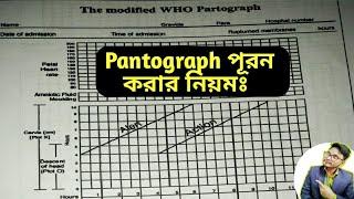 Partograph Kivabe Kore | How to Plot Partograph in Bangla