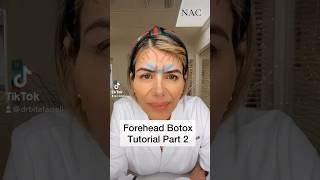 Forehead Anatomy Botox Tutorial Part 2