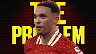 The problem with Trent Alexander-Arnold