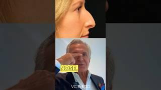 The Nose Job  Dr. Andrew Ordon