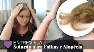 Descubra o que a Nathália faz para solucionar a Alopécia e os cabelos finos e ralos!