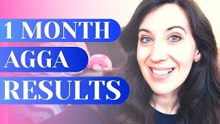 AGGA APPLIANCE REVIEWS [1 MONTH CHECK IN] Why Does My Jaw Hurt? [Chronic Jaw Pain Treatment]