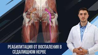 Как убрать воспаление седалищного нерва