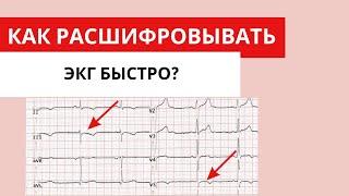 Как быстро расшифровывать ЭКГ? (алгоритм быстрой расшифровки)