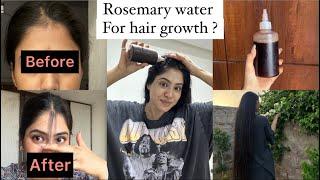 Best Lost hair regrowth remedy  (visible results with proof)