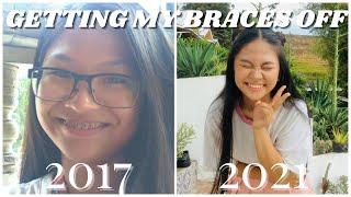 GETTING MY BRACES OFF (after 3 years)