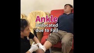 Throwback Year 2017- Chris Leong - Ankle dislocated due to fall