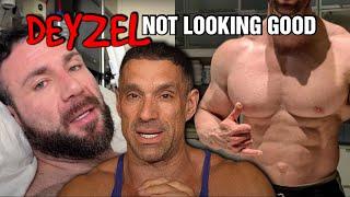 It's Not Looking Good For Noel Deyzel