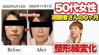 【ほうれい線・ブルドッグ顔】視聴者さんが9ヶ月で変化した方法！