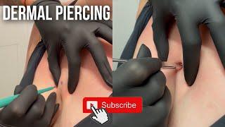 This Is For You If You Want a DERMAL PIERCING! 