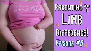 AMPUTEE PARENTS TO BE: Limb Difference + a Baby on the Way