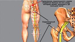 Дарди миен е сутунмухра  табобат ташхис.