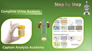 E6.Complete Urine Analysis اذاى تشتغل تحليل البول مانيول بادق الطرق