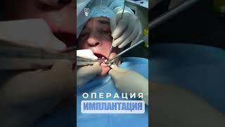 Операция и имплантация. Surgery and implantation.