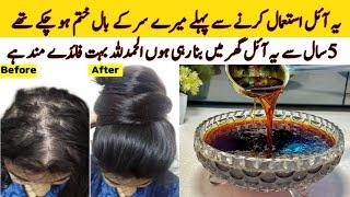 Hair Fall Solution At Home | Onion Hair Oil Remedy For Hair Growth