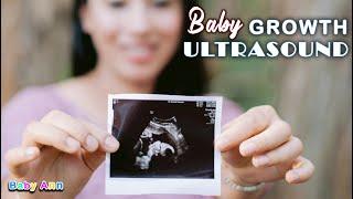 What to Expect During a Baby Growth Ultrasound || Pregnancy Scan || What to expect in Growth scan?