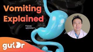 What Happens During Vomiting? | The GutDr Explains (3D Gut Animation)