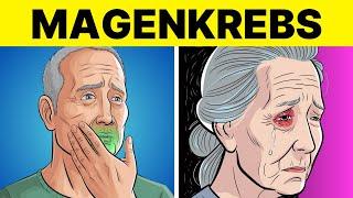 8 Seltsame Anzeichen von MAGENKREBS (Symptome von Magenkrebs)