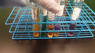 Microbiology: Escherichia coli Biochemical testing interpretation