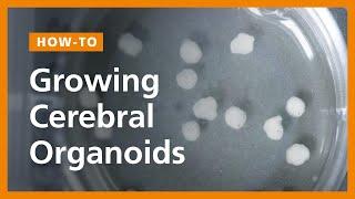 How to Grow Cerebral Organoids from Human Pluripotent Stem Cells