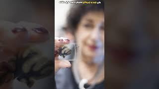 عقایق عجیب مغز آلبرت اینشتین