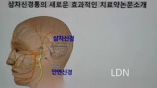 삼차신경통의 새로운 희망적인 치료제 논문소개ㆍ저용량날트렉손(low dose naltrexon )