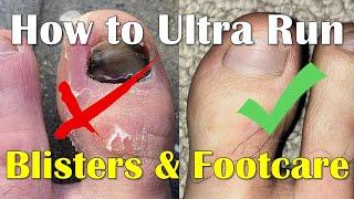 Blisters Prevention and Footcare for runners - How to Run an Ultra Marathon