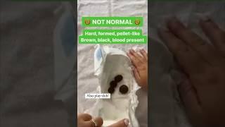 Guide to baby formula poop 