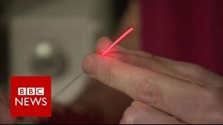 Prostate cancer laser treatment 'truly transformative' - BBC News