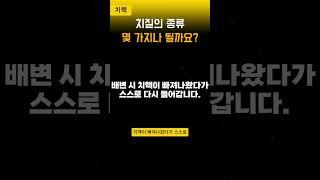 치핵의4단계, 치질의 종류 시리즈