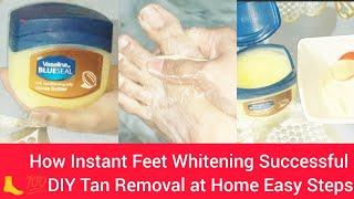 How to Make Your Hands Look 5 Years Younger Overnight! Wrinkle-free smooth fair hands