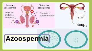 azoospermia