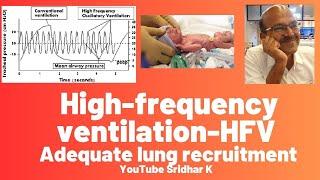 High frequency ventilation l Adequate lung recruitment on HFV