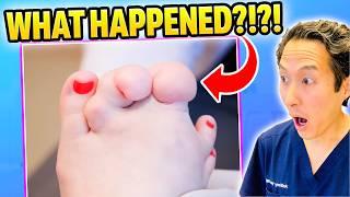 Plastic Surgeon Reacts to MASSIVE FOOT on My Feet Are Killing Me!