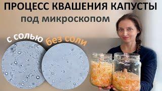 Микрофлора квашеной капусты с 1 по 4 день... Квасить капусту тоже надо уметь!