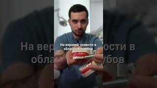 Можно ли  высморкать имплантат через нос?