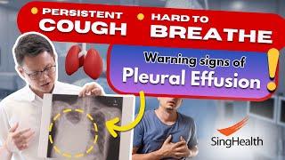 A possible reason for coughs and breathlessness - Pleural Effusion - DOCTORS' ADVICE