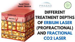 The Different Treatment Depths of ProFractional (Erbium) Laser and Fractional CO2 Laser