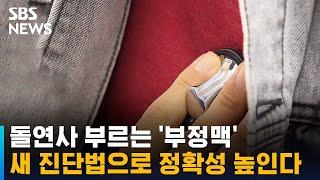 돌연사 부르는 '부정맥'…새 진단법으로 정확성 96%까지 높여 / SBS