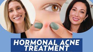 Treat Hormonal Acne with Spironolactone: A Dermatologist Explains | DERM CHAT
