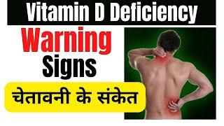 Vitamin D ki deficiency se kya hota hai | Signs and symptoms of vitamin d deficiency