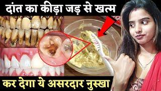 अदरक में ये मिलाकर ब्रश कर लो दांत के कीड़े हो जाए छूमंत्र | Tooth Pain / Toothache