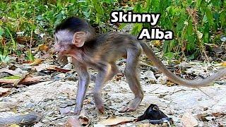 Sorrow And Worry Poor Baby Alba So..So Skinny | She Stand With Exhausted