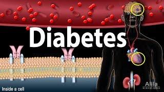 Diabetes mellitus - Symptoms, Complication, Pathology of Type 1 and Type 2, Animation