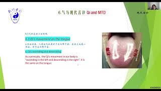 Dr  Haiyan Mao Qi movement observation and MTD