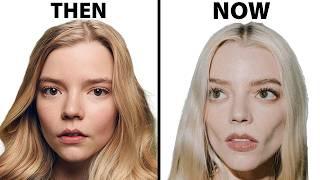 Anya Taylor-Joy's NEW FACE | Plastic Surgery Analysis