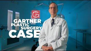 Dr. Gartner Plastic Surgery Case: Facial Rejuvenation. Part 1