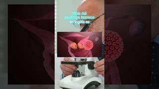 VIRUS DEL PAPILOMA HUMANO EN INGLÉS | Interpretación Consecutiva Medica