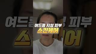 여드름 지성 피부 스킨케어 루틴