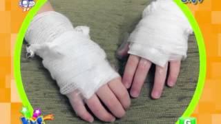 Burn Injury Prevention Month